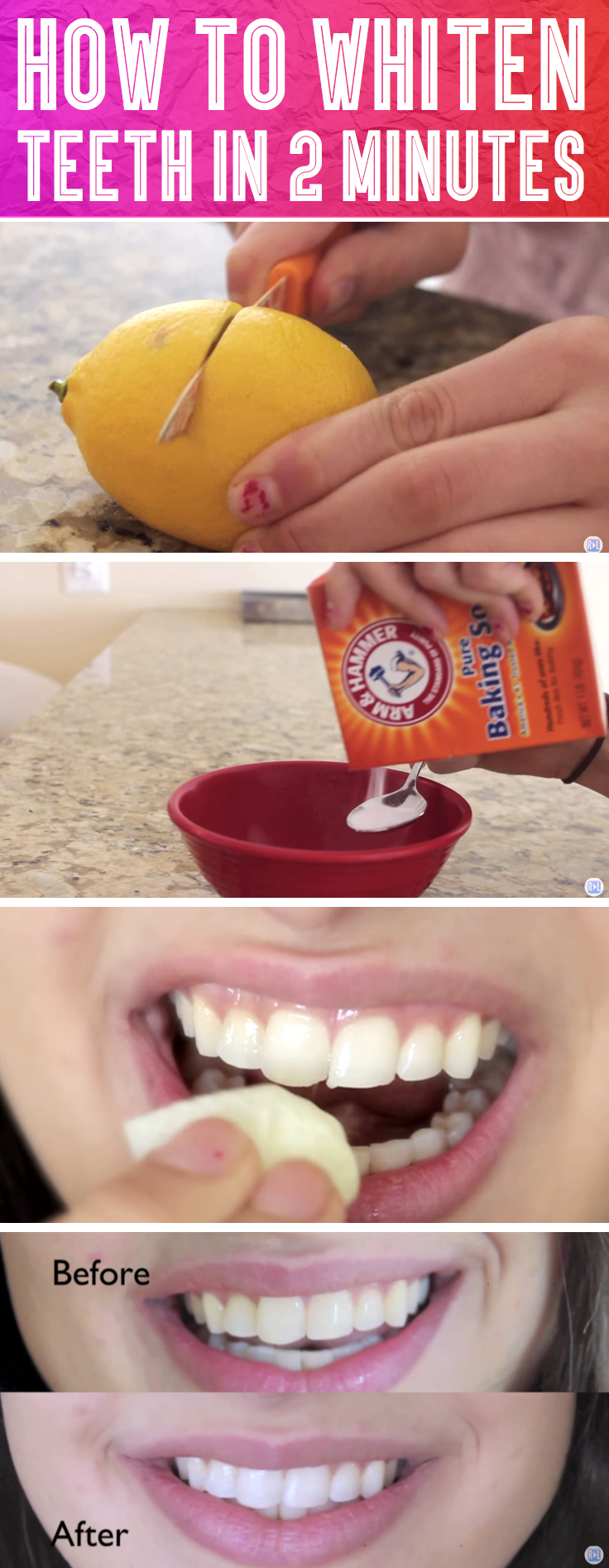 woman-finds-this-strange-trick-to-whiten-her-teeth-in-2-minutes-cover